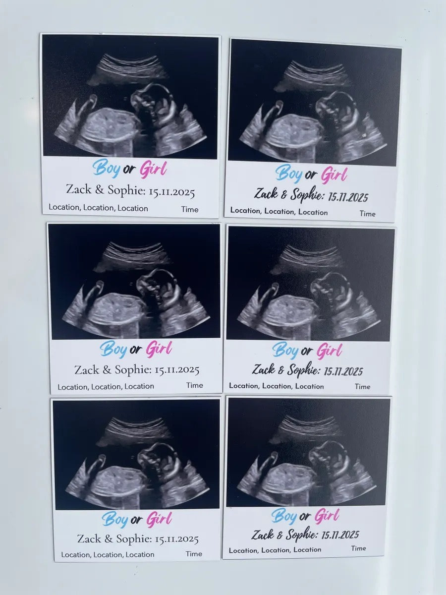 Gender Reveal Invitation Magnets - 3" x 3" - (6 Pack)